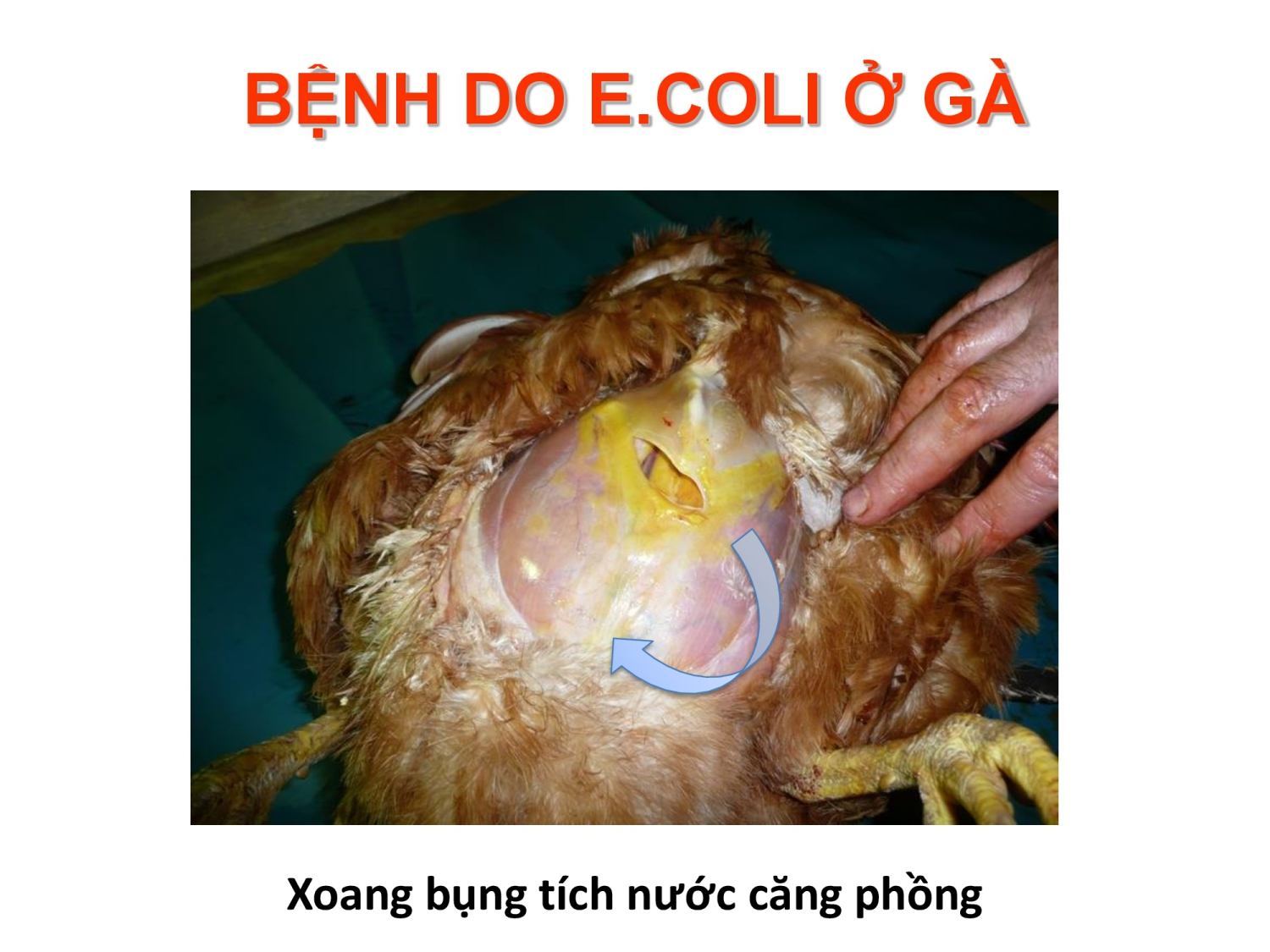 Triệu chứng bệnh Ecoli